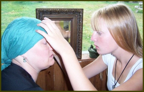 09_04_2009_cancer_funny_eyelashes_chemotherapy_hair_loss
